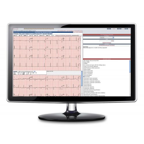Cardio A og B-Palm EKG-programvare for overføring til PC 