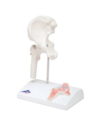 Anatomisk modell av hofteledd med tverrsnitt 