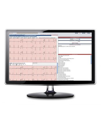 Cardio A og B-Palm EKG-programvare for overføring til PC 